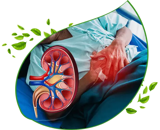 Ayurvedic kidney disorder treatment