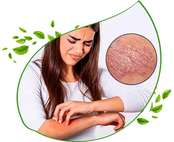 Ayurvedic Skin treatment