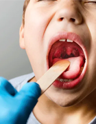 tonsillitis img
